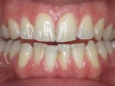 After - Ali Orthodontics Dental