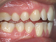 Progressive - Ali Orthodontics Dental