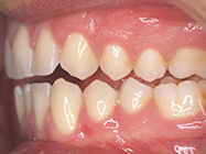 Progressive - Ali Orthodontics Dental