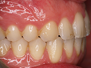 Progressive - Ali Orthodontics Dental