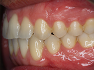 Progressive - Ali Orthodontics Dental