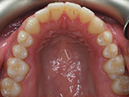 Progressive - Ali Orthodontics Dental