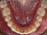 Progressive - Ali Orthodontics Dental