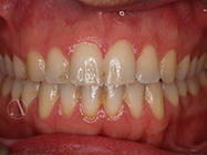 Progressive - Ali Orthodontics Dental