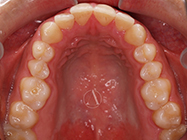 Progressive - Ali Orthodontics Dental