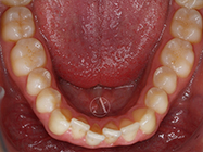 Progressive - Ali Orthodontics Dental