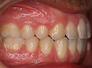 Progressive - Ali Orthodontics Dental