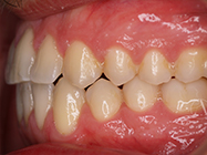 Progressive - Ali Orthodontics Dental