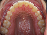 Progressive - Ali Orthodontics Dental