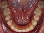 Progressive - Ali Orthodontics Dental