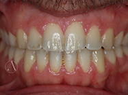 Progressive - Ali Orthodontics Dental