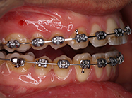 Progressive - Ali Orthodontics Dental