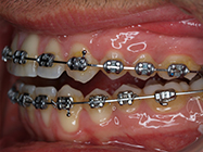 Progressive - Ali Orthodontics Dental