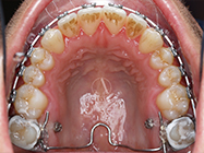 Progressive - Ali Orthodontics Dental