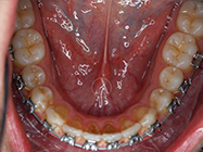 Progressive - Ali Orthodontics Dental