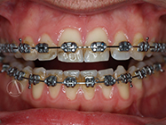 Progressive - Ali Orthodontics Dental