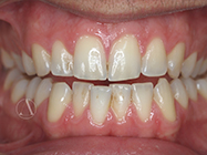 Progressive - Ali Orthodontics Dental