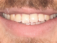 Progressive - Ali Orthodontics Dental