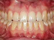 Progressive - Ali Orthodontics Dental