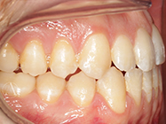 Progressive - Ali Orthodontics Dental