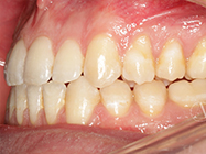 Progressive - Ali Orthodontics Dental