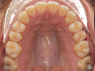 Progressive - Ali Orthodontics Dental