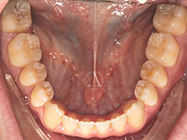 Progressive - Ali Orthodontics Dental