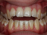 Progressive - Ali Orthodontics Dental