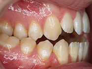 Progressive - Ali Orthodontics Dental