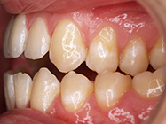 Progressive - Ali Orthodontics Dental