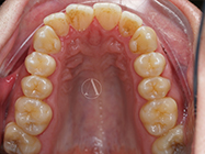 Progressive - Ali Orthodontics Dental