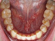 Progressive - Ali Orthodontics Dental