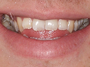 Progressive - Ali Orthodontics Dental