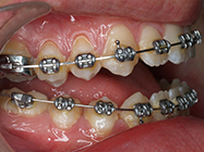 Progressive - Ali Orthodontics Dental