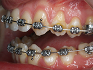 Progressive - Ali Orthodontics Dental