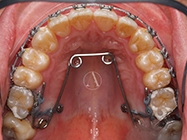 Progressive - Ali Orthodontics Dental