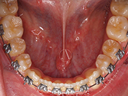 Progressive - Ali Orthodontics Dental