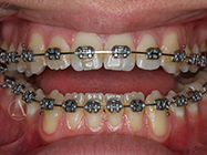 Progressive - Ali Orthodontics Dental