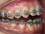 Progressive - Ali Orthodontics Dental