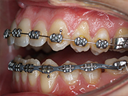 Progressive - Ali Orthodontics Dental