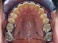 Progressive - Ali Orthodontics Dental