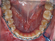 Progressive - Ali Orthodontics Dental