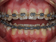 Progressive - Ali Orthodontics Dental