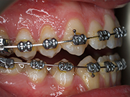 Progressive - Ali Orthodontics Dental