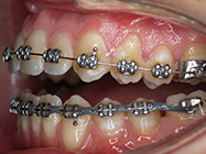 Progressive - Ali Orthodontics Dental