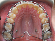 Progressive - Ali Orthodontics Dental