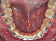 Progressive - Ali Orthodontics Dental