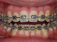 Progressive - Ali Orthodontics Dental