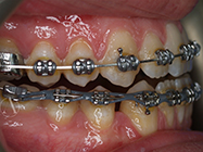 Progressive - Ali Orthodontics Dental