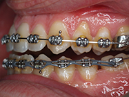 Progressive - Ali Orthodontics Dental